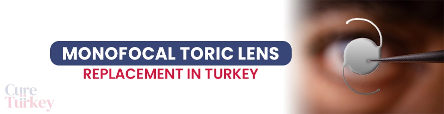 Monofocal Toric Lens